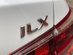 2016 ILX Thumbnail 5