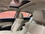 2016 ILX Thumbnail 3
