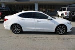 2015 TLX Thumbnail 2