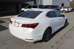 2015 TLX Thumbnail 3