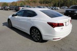 2015 TLX Thumbnail 5