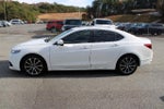 2015 TLX Thumbnail 6