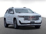 2021 Acadia Thumbnail 1