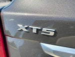 2020 XT5 Thumbnail 12