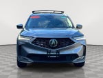 2025 MDX Thumbnail 2