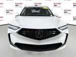2026 MDX Thumbnail 5