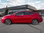 2020 Elantra Thumbnail 2