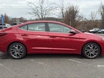 2020 Elantra Thumbnail 2