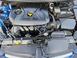 2015 Elantra Thumbnail 32