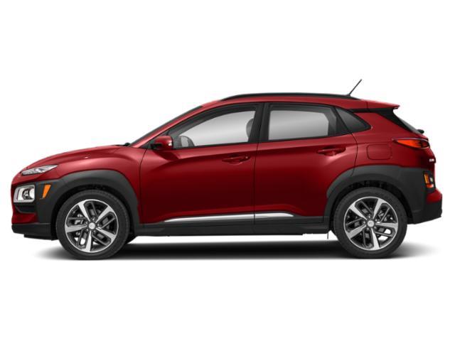 2018 Hyundai KONA Ultimate — photo 1 of 12