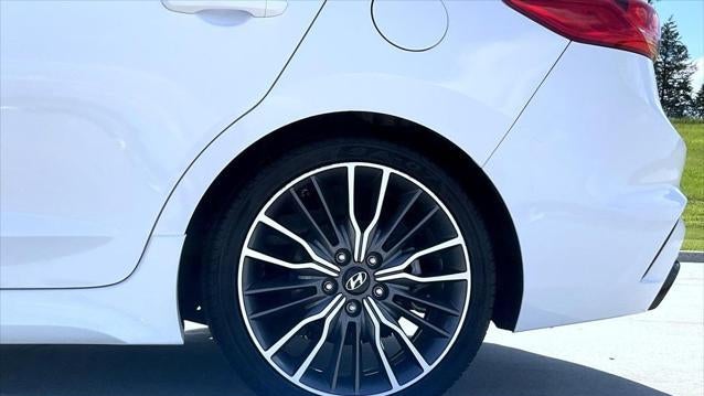 2018 Hyundai ELANTRA Sport