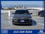 2025 Elantra Thumbnail 3