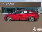 2025 Elantra Thumbnail 2