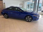2025 Elantra Thumbnail 3