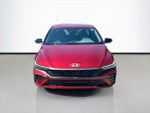 2025 Elantra Thumbnail 2