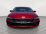 2025 Elantra Thumbnail 2