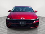 2025 Elantra Thumbnail 2