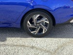 2025 Elantra Thumbnail 5