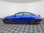 2025 Elantra N Thumbnail 5